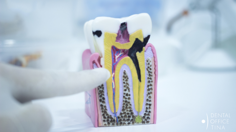 strojna endodoncija